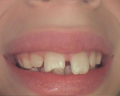 Before Picture